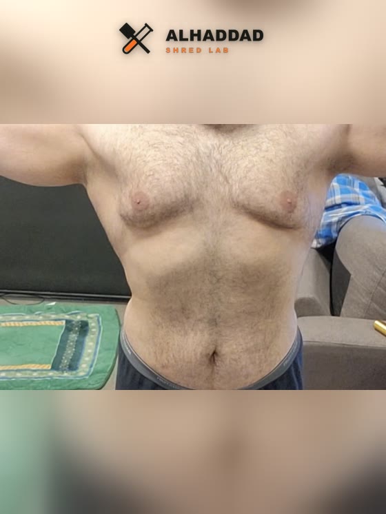 Member transformation after