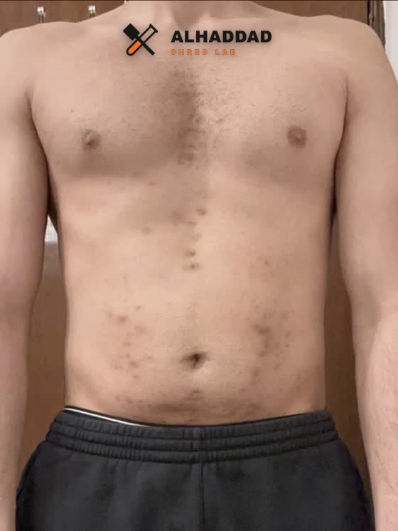 Member transformation before
